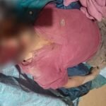 Atropello en Pocona deja un fallecido; familiares impiden traslado al IDIF